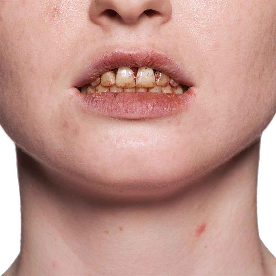 Tooth Enamel
